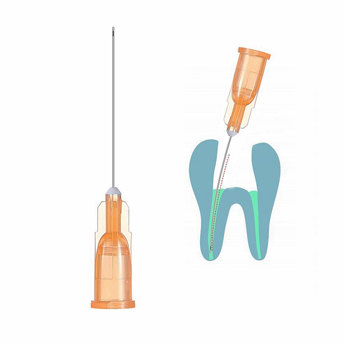 Luer high flow rate Dental Irrigation Needles, thin wall ophthalmology cleaning tool, 30G 27G St.jpg