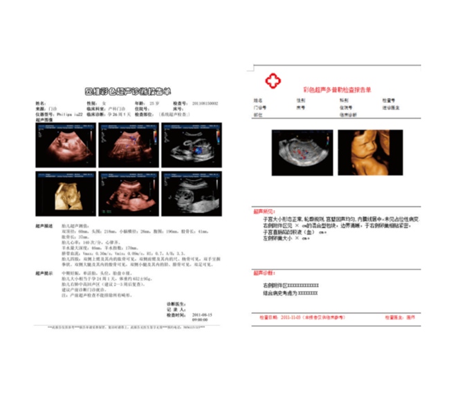 Epson Canon Laser printing film, ultrasound CR DR CT MR DSA 3D reconstruction imaging inkjet Films
